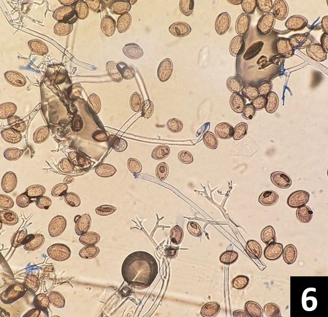 Downy mildew spores under microscope